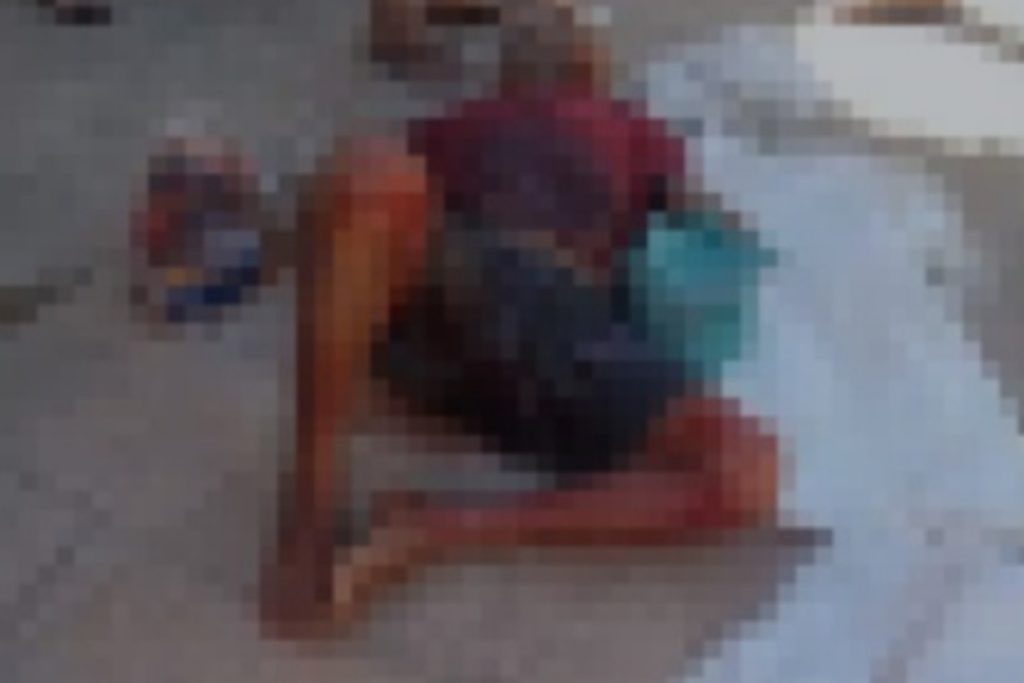 mão decepada Campo Maior